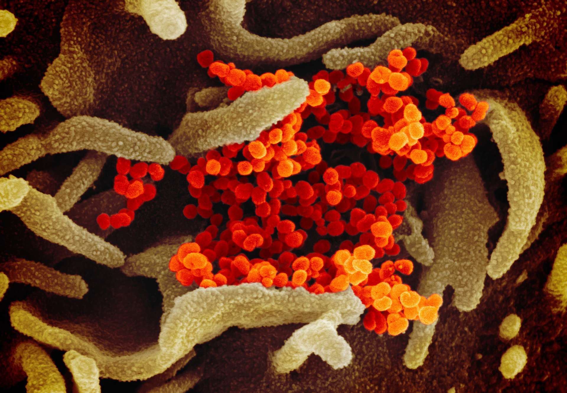 Morocco Announces 3rd Coronavirus Case
