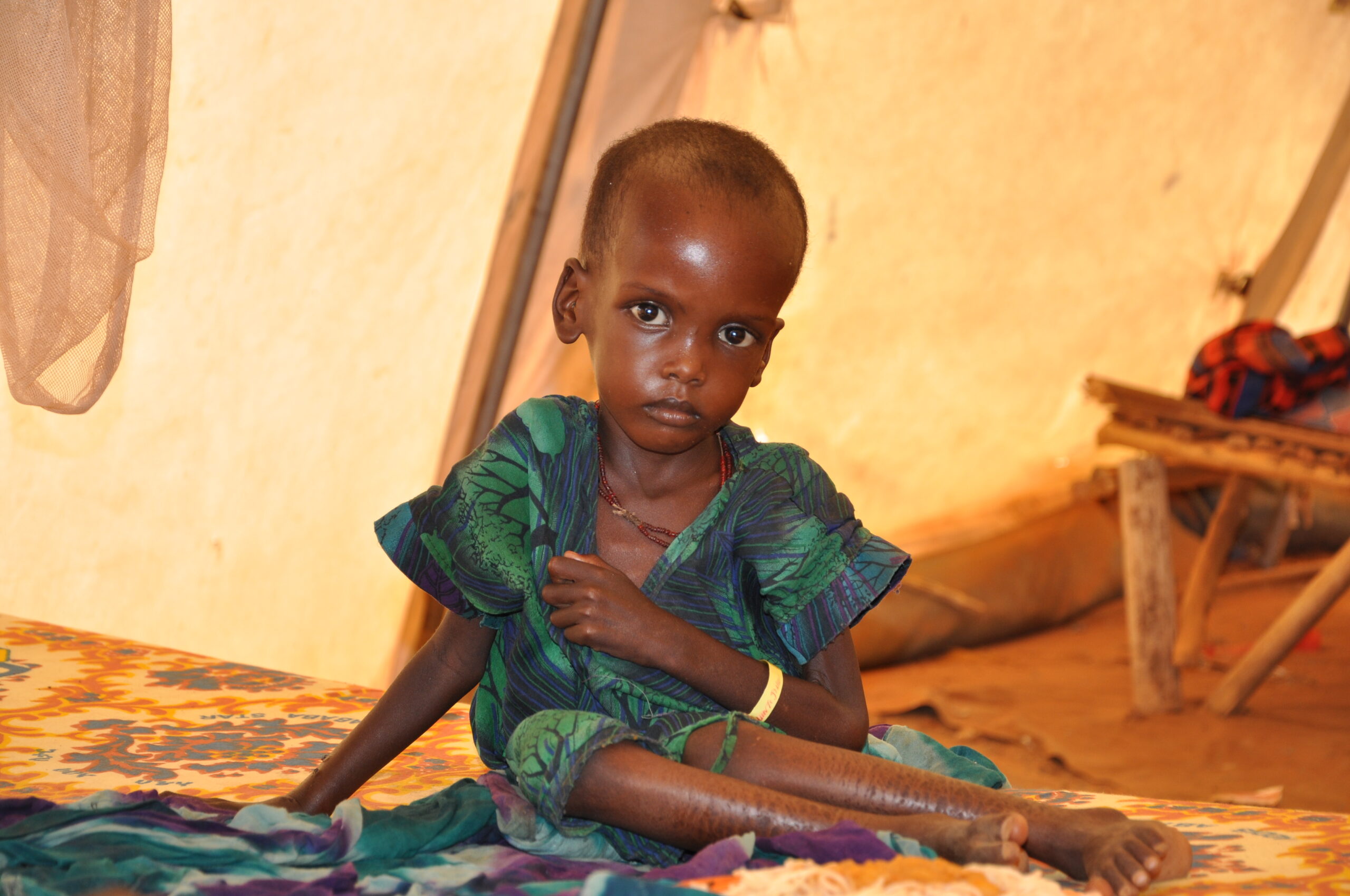 UN appeal for funds to save 30 million malnourished children
